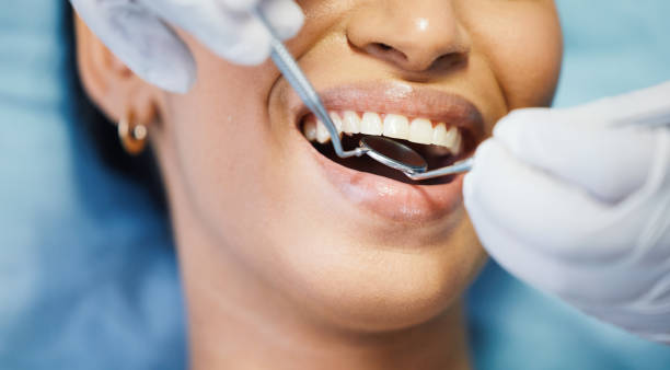 Best Root Canal Emergency Dentist  in Centerfield, UT